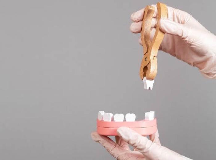 Do You Need a Bone Graft After a Tooth Extraction? What You Need to Know