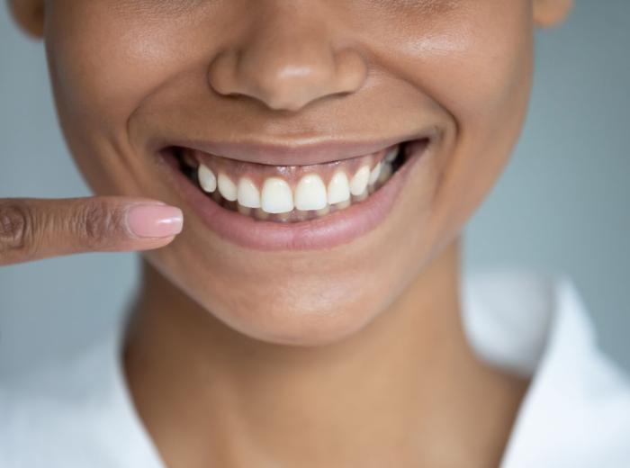 Gum Disease: A "Sneaky" Yet Preventable Health Issue